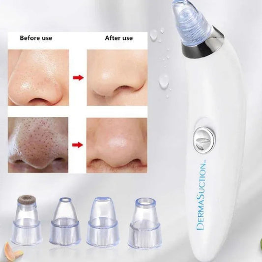 Acne Scar & Dead Skin Remover Tool