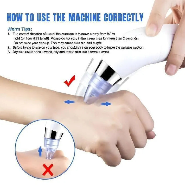Acne Scar & Dead Skin Remover Tool