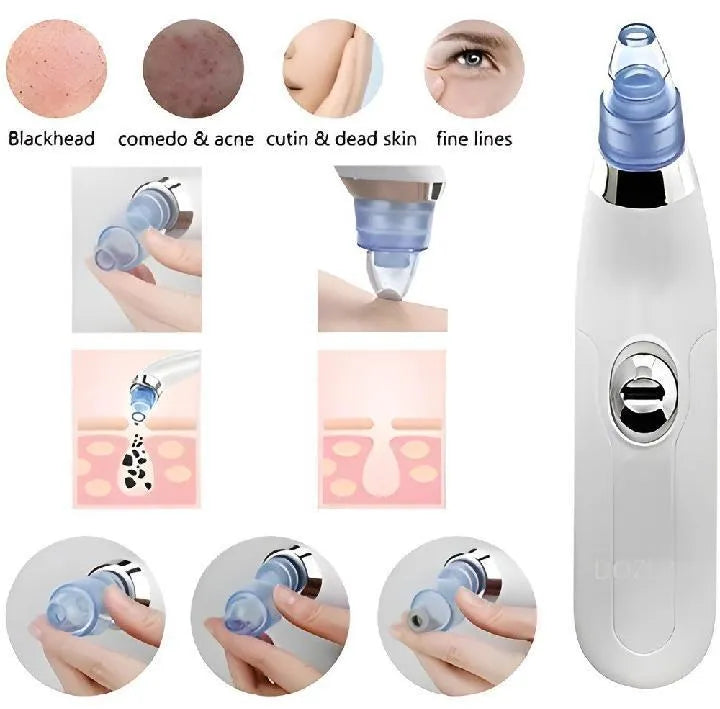 Acne Scar & Dead Skin Remover Tool